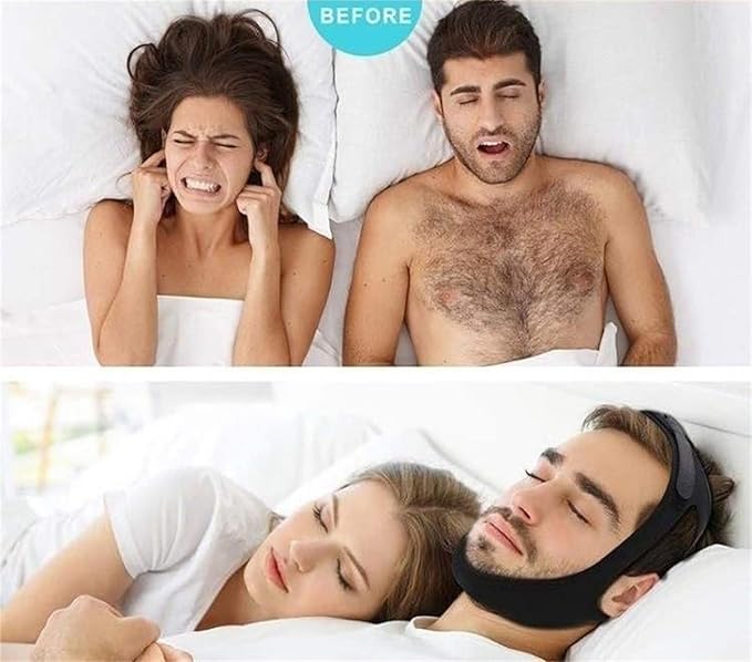 Anti Snoring Chin Strap